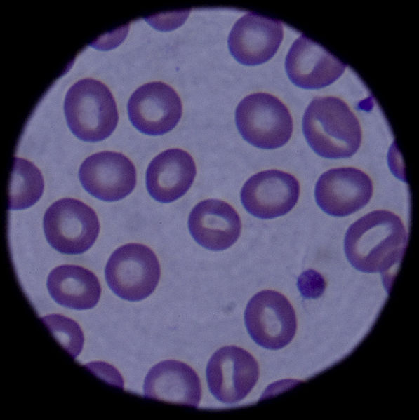 597px-Blood_cells_090304-F-5951M-108